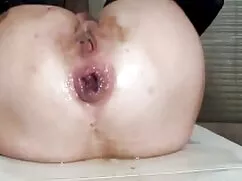 Los xxx tetas Proble ...
