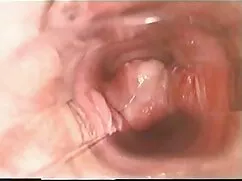 Tiempo de xnxx lesbi ...